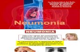 Neumonia y complicaciones.