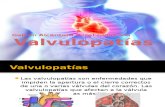 Valvulopatías 3