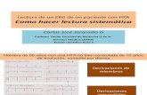 Como Hacer Lectura Sistematica de Un EKG 2016