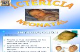 Exposicion Ictericia Materno 33