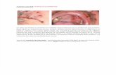 A primera vista 418 (Lesiones en la cavidad oral).docx