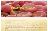 HEMOFILIAS TRABAJO
