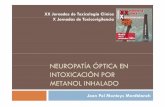 neuropatía óptica en intoxicación por metanol inhalado