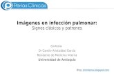 Imágenes en infección pulmonar: signos clásicos y patrones