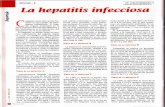 La hepatitis infecciosa
