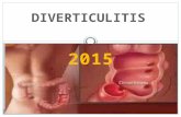 Diverticulitis 2015