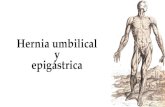 Hernia umbilical y epigastrica
