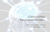 Caso Clínico: Neurocisticercosis