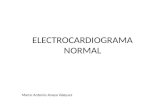 Electrocardiograma Normal-Fisiologia de Guyton