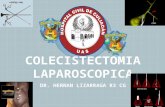 Colecistectomia laparoscopica
