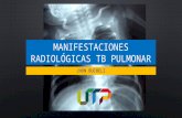Manifestaciones radiológicas tb pulmonar
