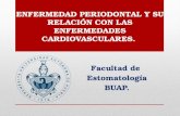 Periodontitis y enfermedad cardiovascular.