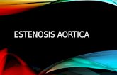 Estenosis aortica ( cardiologia )