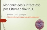 Mononucleosis infecciosa CMV