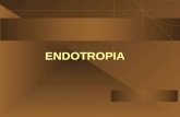 Clasificacion de la endotropia (estrabismo vonvergente)