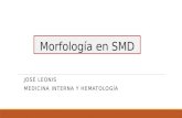 Morfología en SMD