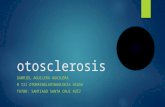 Otosclerosis, tratamiento y complicaciones
