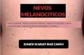 Nevos melanociticos