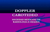 Doppler Carotideo CONFERENCIA