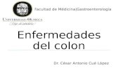 Enfermedad Diverticular y Colitis Ulcerosa