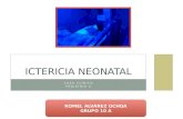 Caso clinico de ictericia neonatal en Hospital "Enrique C. Sotomayor" Guayaquil-Ecuador.