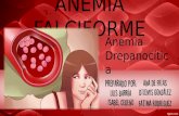 Anemia falciforme y Síndrome de Edwards