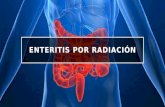 Enteritis por radiación