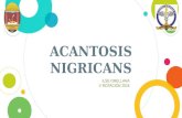 Acantosis nigricans