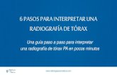 6 pasos-para-interpretar-una-radiografia-de-torax