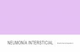 Neumonía intersticial - Anatomía patológica especial