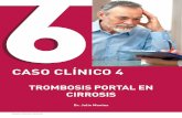 CASO CLÍNICO 4 - catedratrombosis.comcatedratrombosis.com/wp-content/uploads/2017/03/casoclinico04-1.pdf · CASO CLÍNICO - Trombosis portal en cirrosis MOTIVO DE INGRESO Varón