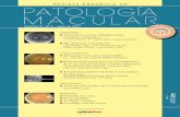R E V I S TA E S PA Ñ O L A D E PATOLOOÍA M A C U L Aamqoftalmos.es/web/docs/Patología Macular - Vol. III - Número 2...aparece membrana neovascular, no se ha demostrado ninguna