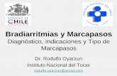 Bradiarritmias y Marcapasos - SMS CHILE · Segundo grado avanzado (varias ondas p bloqueadas) ... Año de Implante Implante de Marcapasos VVI versus DDD en Hospitales del SNS 2004