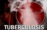 Presentación de PowerPoint - saludpublicaiiunahvs · La tuberculosis Enfermedad crónica infectocontagiosa, causada por el complejo Mycobacterium tuberculosis, que afecta principalmente
