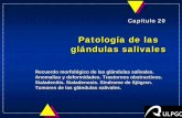 Patología de las glándulas salivales - personales.ulpgc.es 20.-Glandulas... · PATOLOGPATOLOGÍA DE LAS GLÁNDULAS SALIVALESÍA DE LAS GLÁNDULAS SALIVALES DIAGNÓSTICO uHistoria