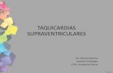 TAQUICARDIAS SUPRAVENTRICULARES - … · TAQUICARDIAS SUPRAVENTRICULARES Dra. Mariana Martino Asistente Cardiología CCVU. Hospital de Clinicas