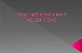 elementos dentarios erupcionados , contacto con …ecaths1.s3.amazonaws.com/anatomiapatologicaodontount/1051176314... · Hipercementosis ... grave y extensa provocadas por traumatismos