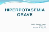 HIPERPOTASEMIA GRAVE - dep4.san.gva.es · La más grave de las alteraciones hidroelectrolíticas por riesgo de arritmias ventriculares fatales.