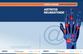 ARTRITIS REUMATOIDE - …formaciones.elmedicointeractivo.com/registros_respon/147_artritis/... · Criterios para la clasificación de artritis reumatoide. Análisis de laboratorio.