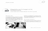 Diagnóstico por la imagen en las bronquiectasiasneumologiaysalud.es/descargas/M1/M1-3.pdf · moco o líquido. En algunas ocasiones los bron-quios, llenos de secreciones, pueden visualizarse