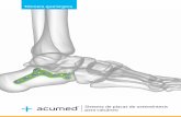 Sistema de placas de osteosíntesis para calcáneo - … · 3 Técnica uirúrgica del istema de placas de osteosíntesis para calcáneo de cumed® Características del sistema de