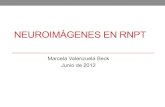 NEUROIMÁGENES EN RNPT - Neo Puerto Montt · • Tomografía computada: se utiliza infrecuentemente en RNPT (últimas publicaciones en cerebro de RNPT ! ... • Hiperecogenicidad