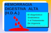 HEMORRAGIA DIGESTIVA ALTA (H.D.A.) - …files.javier-montero-perez.webnode.es/200000035-e2f81e3c2d/HDA... · Y el Tratamiento De Urgencia (H.D.A.) ... Hemorragia digestiva alta: diagnóstico