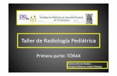 Taller de Radiología Pediátrica - Sociedad de Pediatría ... · • Desplazamiento del mediastino contralateral • Derrame pleural derecho QUILOTÓRAX. Hemitórax blanco en RN