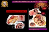 EMBARAZO ECTOPICO - educaperu.com.pe · EMBARAZO ECTOPICO:Implantación del cigoto fuera de los límites del endometrio y se produce 1 /100-200 Embarazos y su incidencia está en