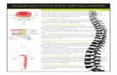 bloqueo selectivo de raíces nerviosas lumbaresesp.drzarembinski.com/articles/esppdf/Lumbar ESI SNRB 061606.pdf · El área lumbar de la espina dorsal tiene cinco huesos, llamados