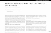 INfECCIONES vIRALES EN pIEL y MuCOSAS · Artículo aprobado para publicación: 28-09-2011 INfECCIONES vIRALES EN pIEL y MuCOSAS CuTANEouS vIRAl DISEASES DrA. MAríA José MArtínez