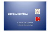 BIOPSIA HEPÁTICA - eloizaquintela.com.breloizaquintela.com.br/biopsia_hepatica.pdf · • VIN SILVERMAN SUCCION: • MENGHINI • KLATSKIN • JAMSHIDI ... Uso de AINES 7 a 10 días