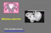 Mioma uterino - uvsfajardo.sld.cuuvsfajardo.sld.cu/sites/uvsfajardo.sld.cu/files/mioma_uterino.pdf · valor sonografía con infusión ClNa ... obstrucción parcial a su drenaje venoso