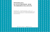 MANUAL ILUSTRADO EN TUBERCULOSIS - … · manual ilustrado en tuberculosis para el personal de la inspecciÓn veterinaria en frigorÍficos y mataderos bovinos